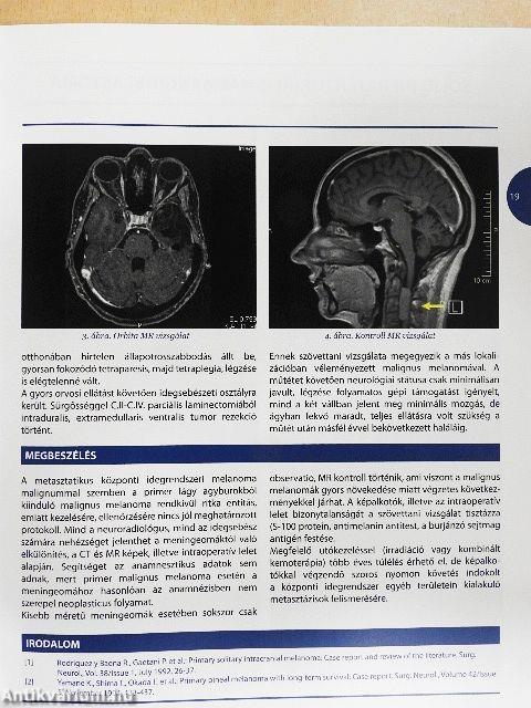 A fej-nyak régió betegségeinek interdiszciplináris bemutatása