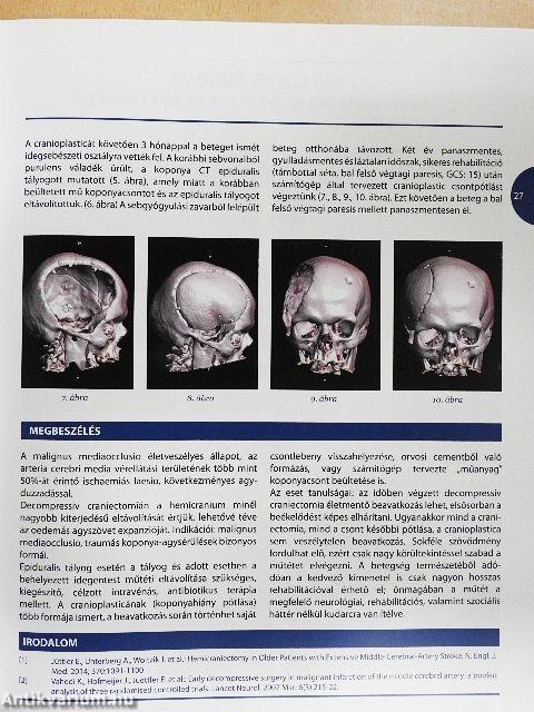 A fej-nyak régió betegségeinek interdiszciplináris bemutatása