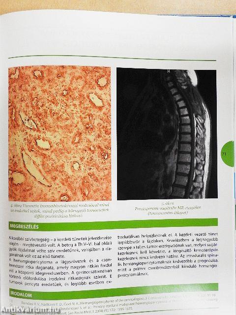 Stratégiai szempontok a mozgásszervi betegségek kezelésében