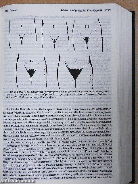 MSD Orvosi Kézikönyv