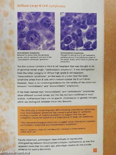 Lymphoma Classification
