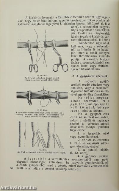 Hadisebészet