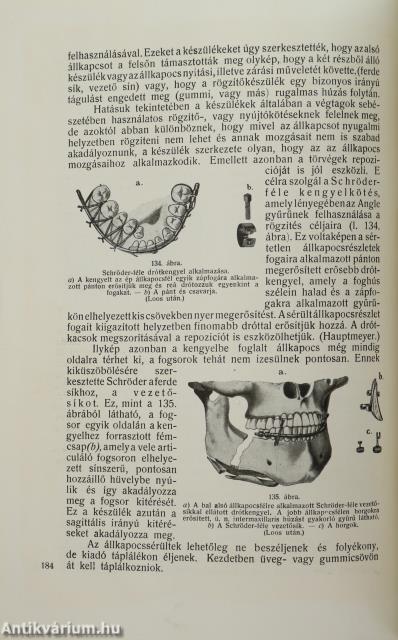Hadisebészet
