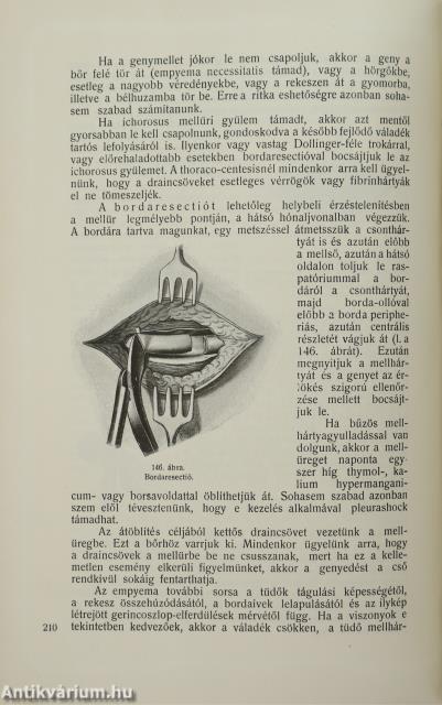 Hadisebészet
