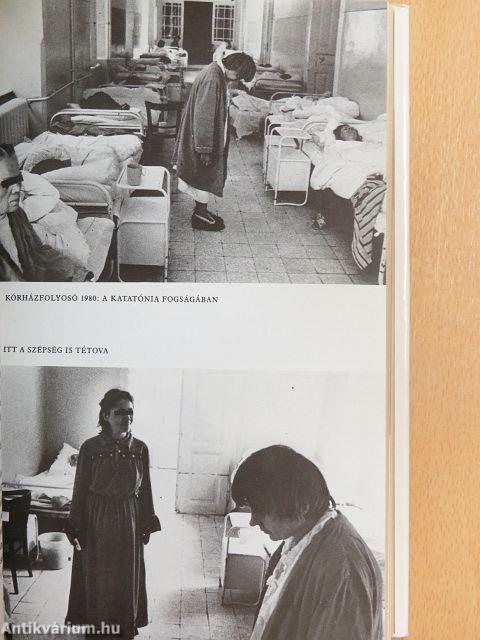 Téboly/terápia/stigma