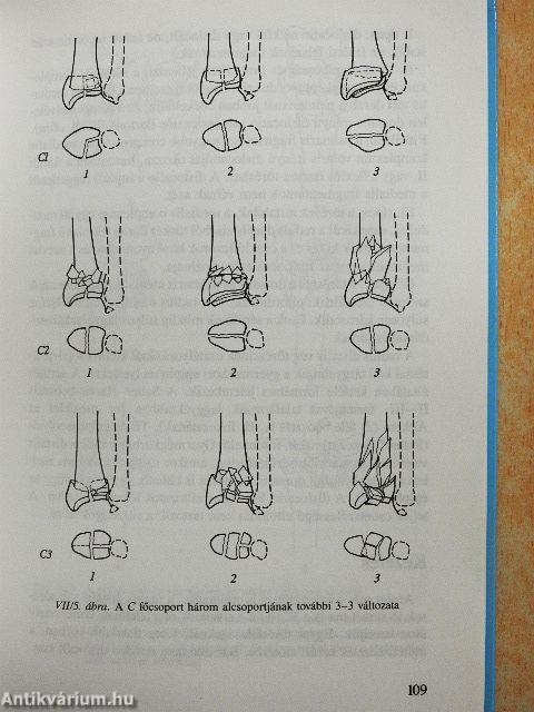 A kéztő fedett sérülései, elváltozásai