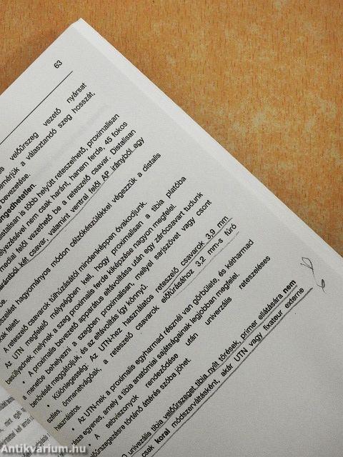 Intramedulláris rögzítés