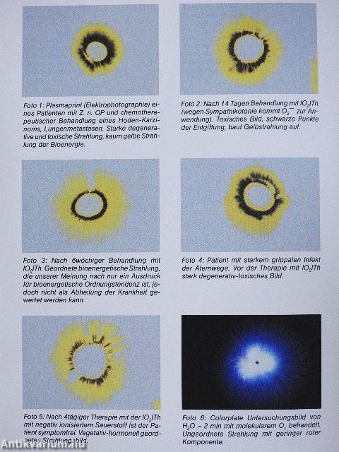 Ionisierter Sauerstoff