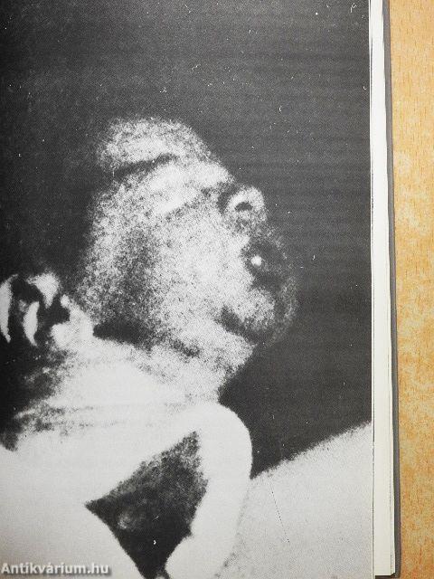 A gyöngéd születés