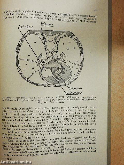 Tanulmányok a szívárnyékról