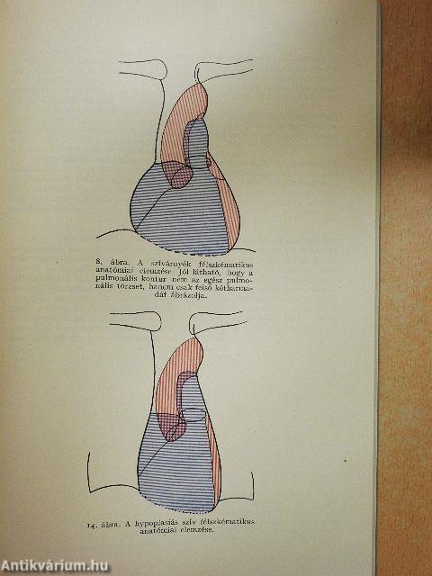 Tanulmányok a szívárnyékról