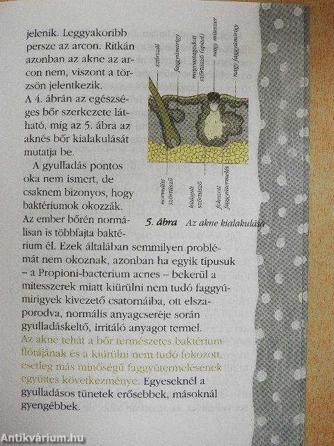 Amit a pattanásról tudni kell!