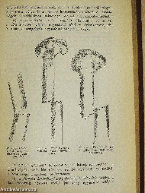 Általános sebészet