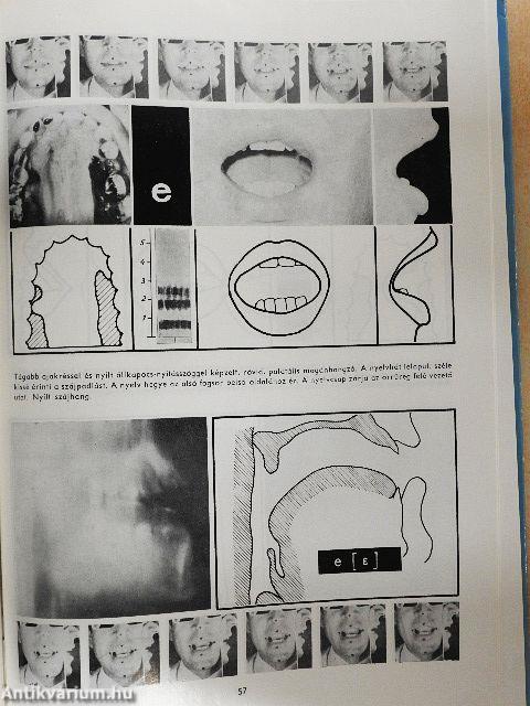 A magyar beszédhangok atlasza