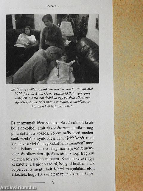 Idegsebészet és hétköznapi misztika