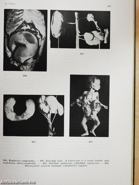 Általános kórbonctan