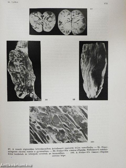 Általános kórbonctan