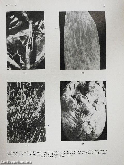 Általános kórbonctan