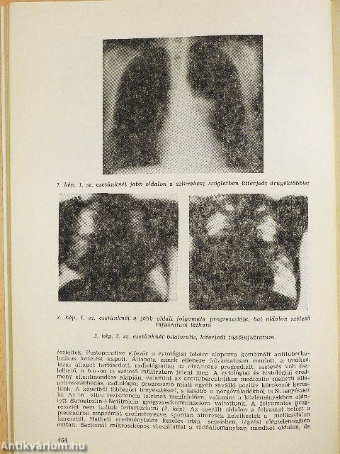 Medicina Thoracalis 1989. október