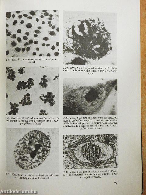 Klinikai mikrobiológia
