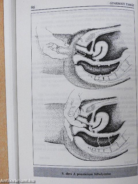 Beszéljünk erről...