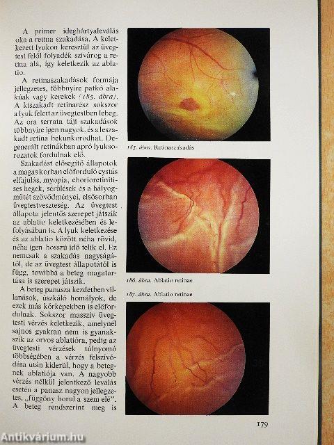 A szemészet alapvonalai 