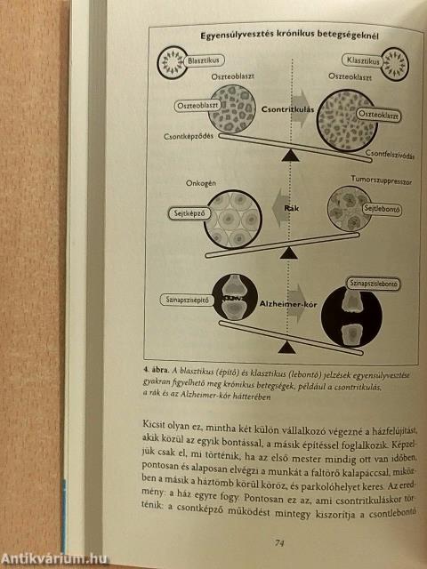 Az Alzheimer-kór vége