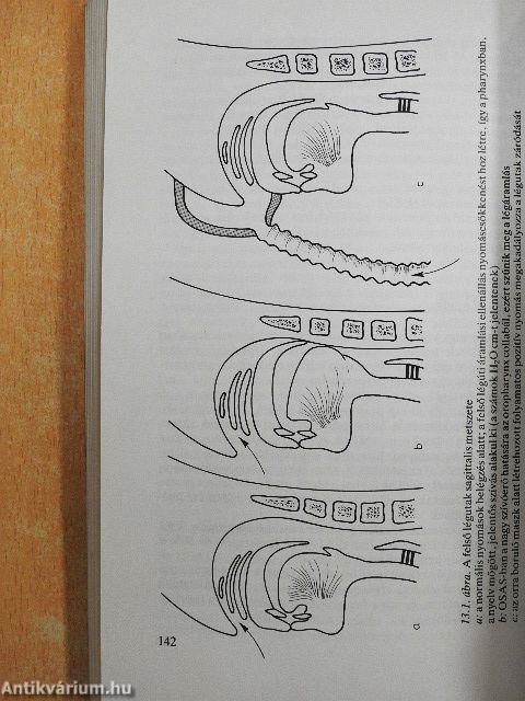 Pulmonológia