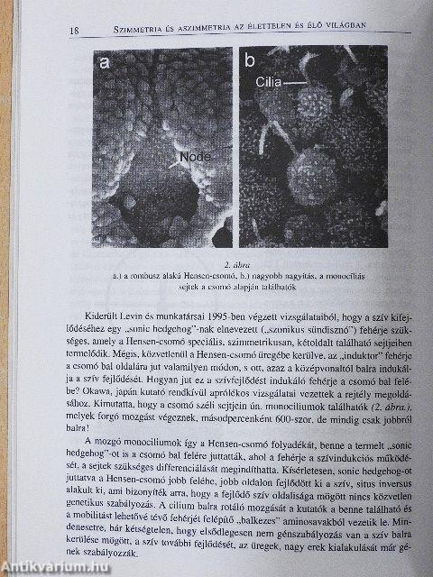 Az emberi agy aszimmetriái