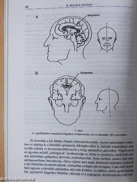 Az emberi agy aszimmetriái