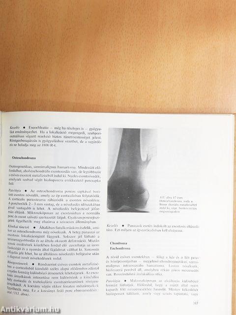 Az ortopédia tankönyve