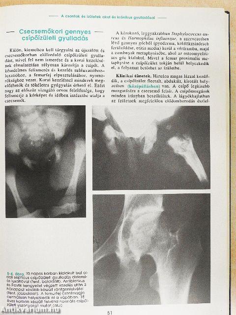 Az ortopédia tankönyve