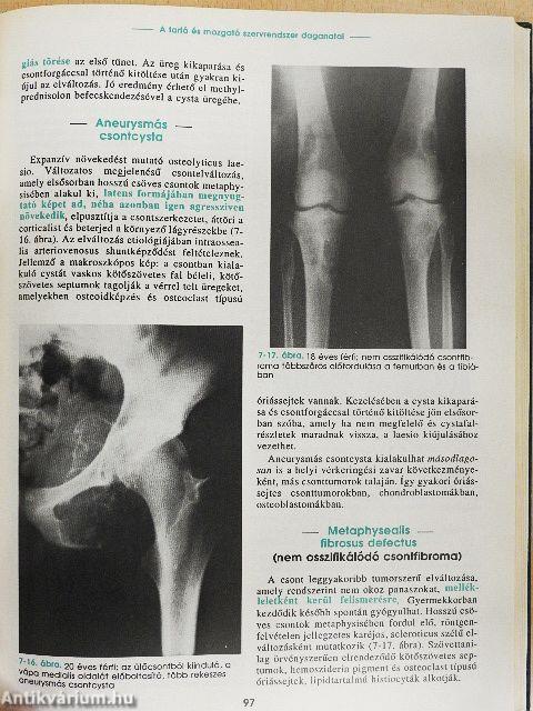 Az ortopédia tankönyve