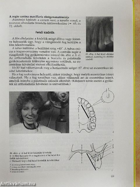 Fogászati radiológia