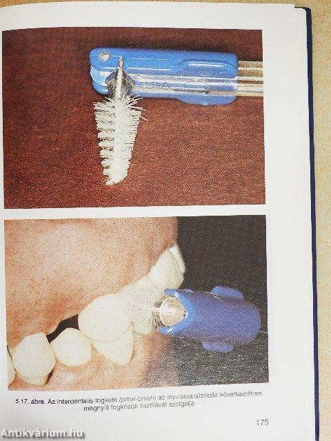 Preventív fogászat