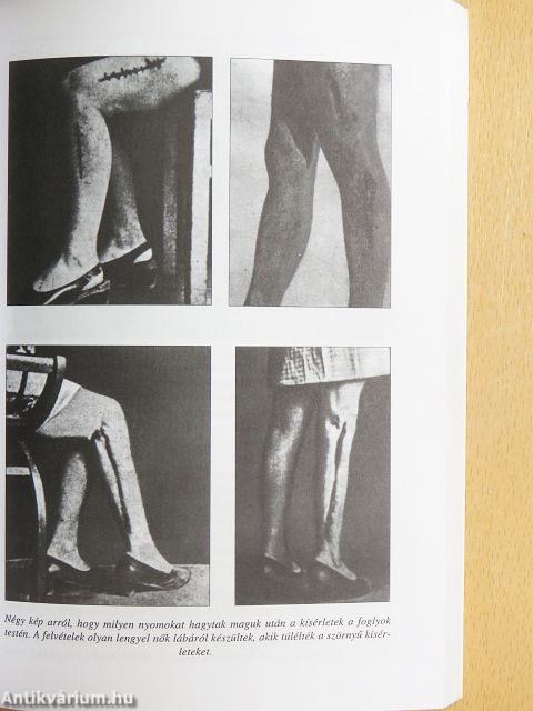 Hitler halálgyárai