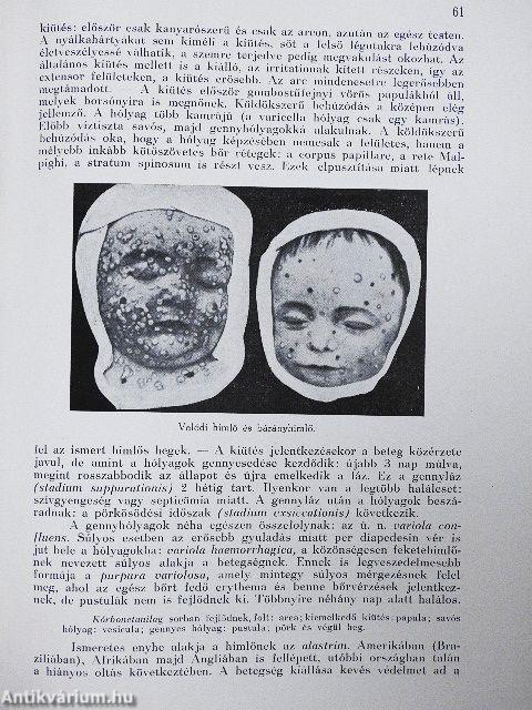 Közegészségtan III.