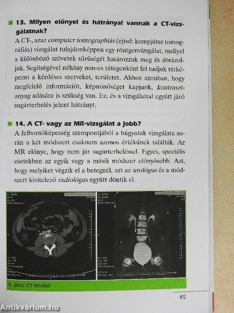 Urológiai betegségek