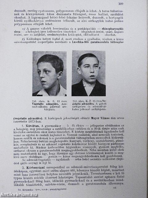 Orr-, torok-, gégegyógyászat