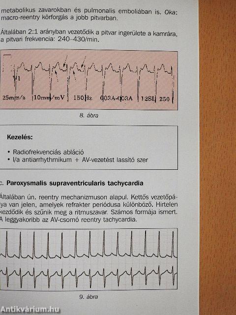 EKG alapismeretek