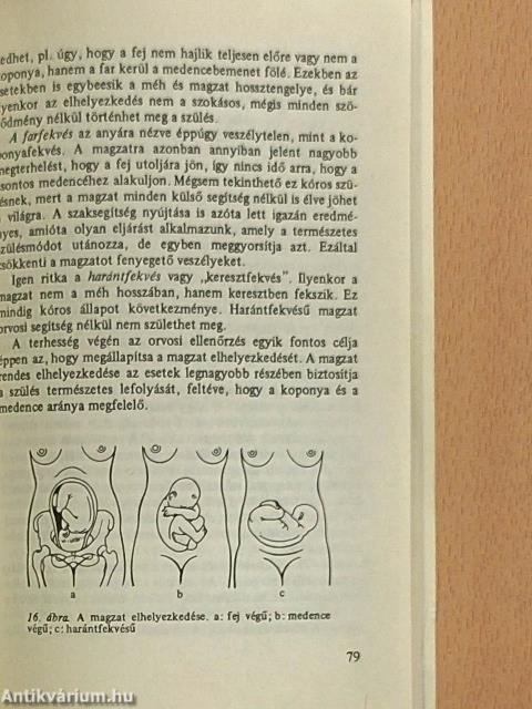 Szülőszoba, tessék belépni!