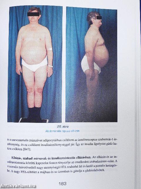 Metabolicus syndroma