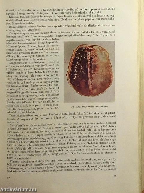 Igazságügyi orvostan