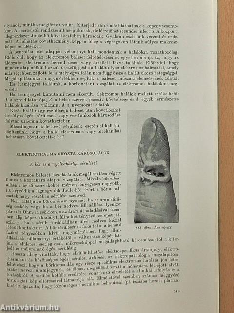 Igazságügyi orvostan