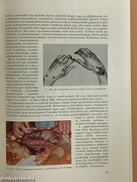 Igazságügyi orvostan