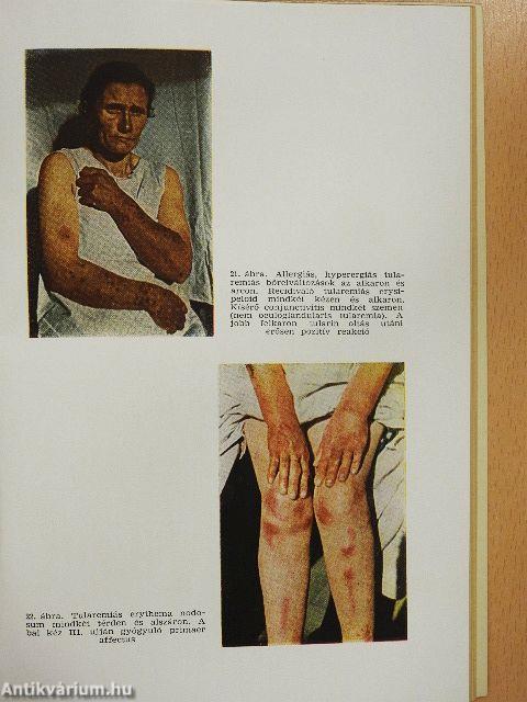 Újabb fertőző betegségek