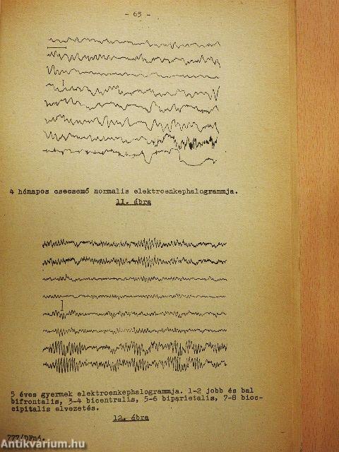 Elektroenkephalographia