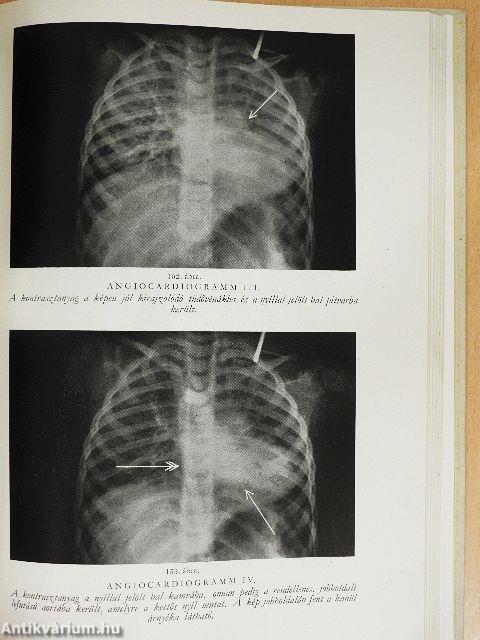 Röntgenanatómia I-II.