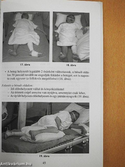 A bénult beteg és ápolása