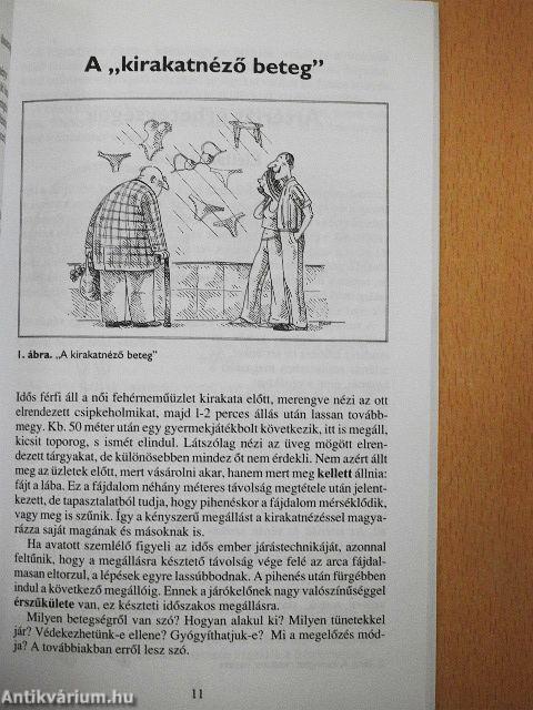 Érbetegségekről mindenkinek